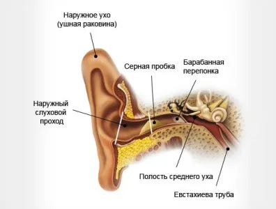 Сірчана пробка у вусі у дитини, що робити, як лікувати в домашніх умовах (дитини) Сірчана пробка у вусі у дитини, що робити, як лікувати в домашніх умовах