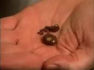 Сольовий діатез нирок лікування народними засобами, лікування народними засобами (народними) Сольовий діатез нирок лікування народними засобами, лікування народними засобами