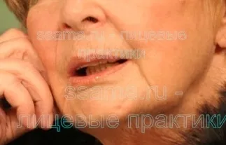 Спазми і гіпертонус м'язів обличчя - зможу сама (піднімальних верхню) Спазми і гіпертонус м'язів обличчя - зможу сама