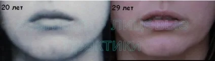 Спазми і гіпертонус м'язів обличчя - зможу сама (роботі) Спазми і гіпертонус м'язів обличчя - зможу сама