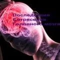 Стеноз судин головного мозку, симптоми і лікування (судин) Стеноз судин головного мозку, симптоми і лікування