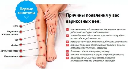 Трави при варикозі рецепти народної медицини (народної) Трави при варикозі рецепти народної медицини