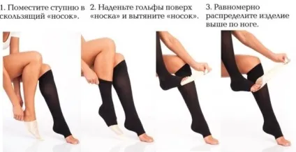 Варикозна екзема нижніх кінцівок - і її лікування (нижніх) Варикозна екзема нижніх кінцівок - і її лікування