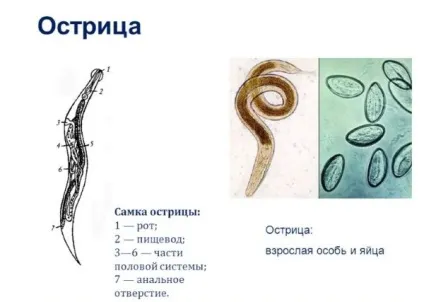 У дитини свербіж в інтимній зоні (інтимної) У дитини свербіж в інтимній зоні