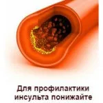 Вибір масажера після інсульту і правила проведення процедури (після) Вибір масажера після інсульту і правила проведення процедури