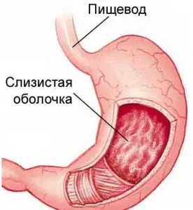 Хронічний гастрит і гастродуоденіт в чому різниця, чим відрізняються лікування і дієта, що гірше