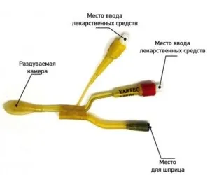 ЯМІК-процедура при лікуванні гаймориту (ЯМІК-процедура) ЯМІК-процедура при лікуванні гаймориту