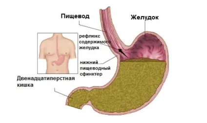 7 Ознак інтоксикації печінки - крок до здоров'я