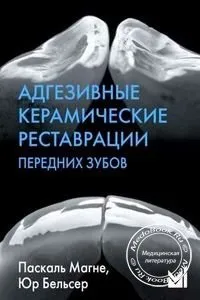 Адгезивні керамічні реставрації передніх зубів, паскаль Магне, 2012 р, медична література, (2012) Адгезивні керамічні реставрації передніх зубів, паскаль Магне, 2012 р, медична література,