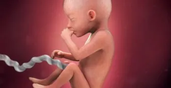 Амниотические перетяжки причини розвитку патології і можливі наслідки (перетяжки) Амниотические перетяжки причини розвитку патології і можливі наслідки
