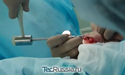 Олексію Самсонова зробили ніс - дивитися будинок 2 онлайн (зробили) Олексію Самсонова зробили ніс - дивитися будинок 2 онлайн