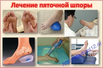 Як вилікувати п'яткову шпору традиційними методами (вилікувати п'яткову шпору) Як вилікувати п'яткову шпору традиційними методами