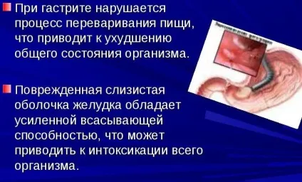 Болить живіт на голодний шлунок - саме коли голодний! (Болить) Болить живіт на голодний шлунок - саме коли голодний!