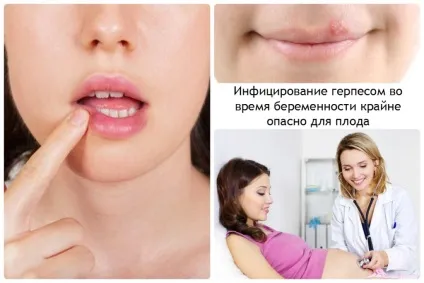 Чим небезпечний герпес для людини, і які симптоми викликані вірусом (людини) Чим небезпечний герпес для людини, і які симптоми викликані вірусом