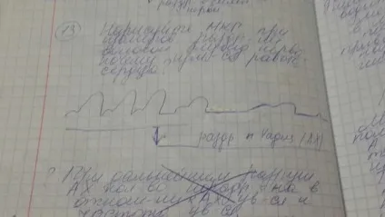 Що таке протодиастолический період, чому він дорівнює