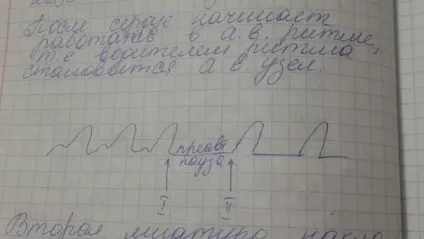 Що таке протодиастолический період, чому він дорівнює