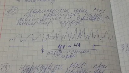 Що таке протодиастолический період, чому він дорівнює
