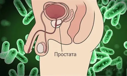 Що таке простатит у чоловіків - причини, ознаки, симптоми і лікування (таке) Що таке простатит у чоловіків - причини, ознаки, симптоми і лікування