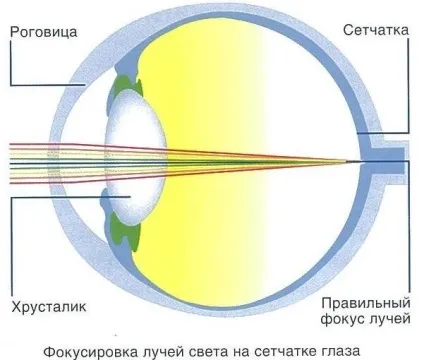 Що таке астигматизм і чи є він у вас