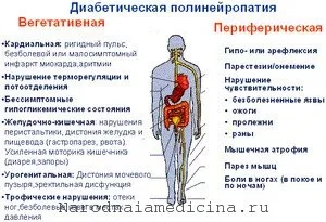 Діабетична полінейропатія (діабетична) діабетична полінейропатія