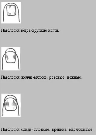 Діагностика по нігтях в східній медицині (всмоктуваність їжі системі) Діагностика по нігтях в східній медицині