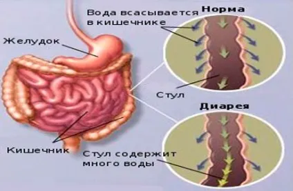 Діарея лікування в домашніх умовах у дорослих (лікування) Діарея лікування в домашніх умовах у дорослих