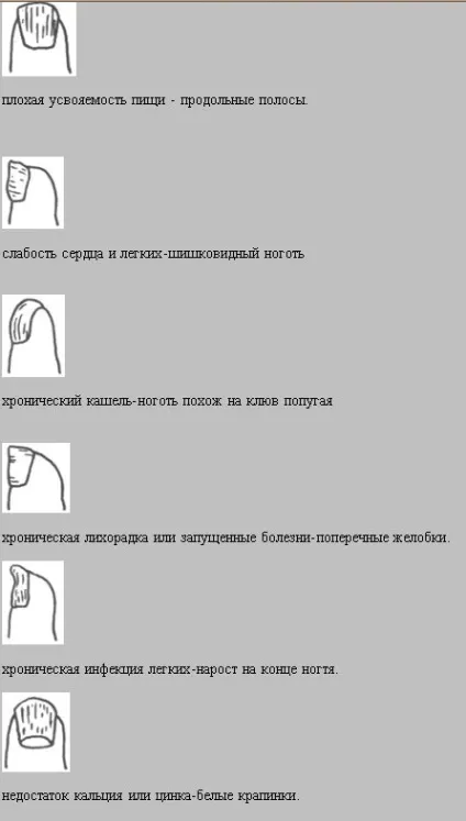 Діагностика по нігтях в східній медицині (нігтям) Діагностика по нігтях в східній медицині