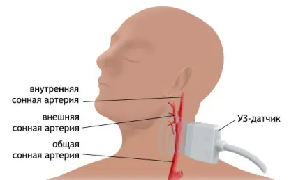 Дуплексне сканування судин голови та шиї (дуплексне) Дуплексне сканування судин голови та шиї