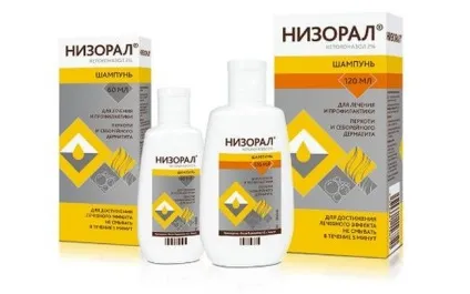 Екзема на голові симптоми, стадії, різновиди (всіх лікарських рекомендацій) Екзема на голові симптоми, стадії, різновиди