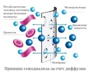 Гемодіаліз, фільтрація крові