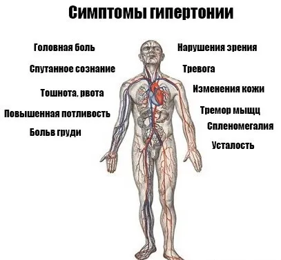 Гіпертонія у жінок причини, симптоми і лікування (гіпертонія) Гіпертонія у жінок причини, симптоми і лікування