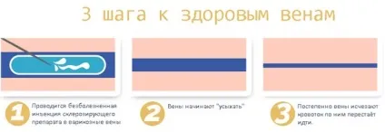 Гемангіома печінки - форми, причини, симптоми, лікування