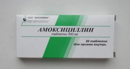 Гастрит з підвищеною кислотністю симптоми, ознаки, лікування (гастрит) Гастрит з підвищеною кислотністю симптоми, ознаки, лікування