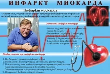 Інфаркт трансмуральний симптоми і причини, прояв на ЕКГ, ЛФК, прогноз