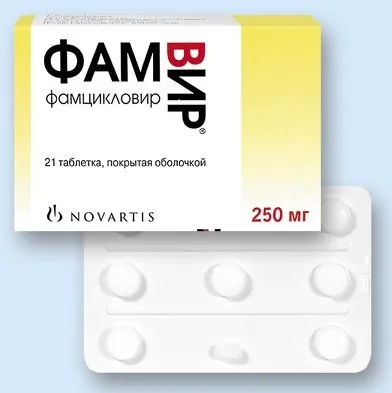 Як швидко вилікувати герпес на губі - народні поради (вилікувати) Як швидко вилікувати герпес на губі - народні поради