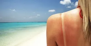 Як лікувати тепловий удар