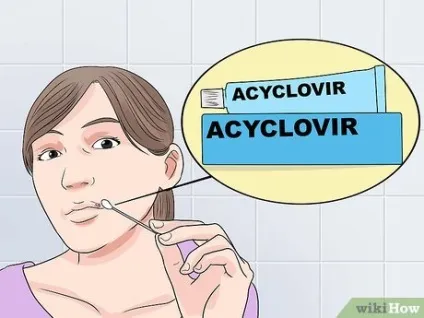 Як зупинити зростання герпесу