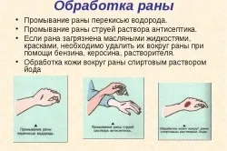 Як правильно обробляти рану йодом
