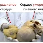 Як зробити серце здоровим здоровий спосіб життя (здоровим) Як зробити серце здоровим здоровий спосіб життя