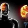 Як видалити родимку народними засобами лікування (родимку) Як видалити родимку народними засобами лікування
