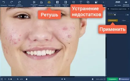 Як прибрати прищі на фото, усунення недоліків на фото (скачати) Як прибрати прищі на фото, усунення недоліків на фото