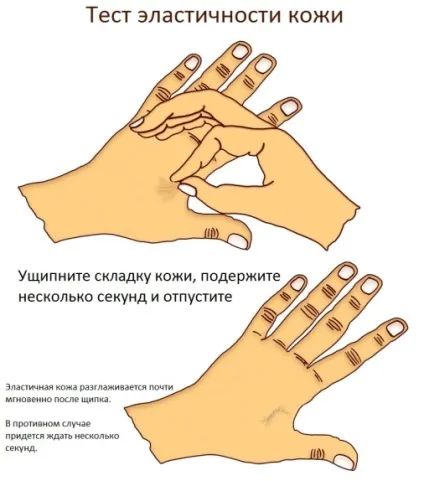 Як прибрати обвислі шкіру після схуднення проблема обвисання шкіри (схуднення) Як прибрати обвислі шкіру після схуднення проблема обвисання шкіри