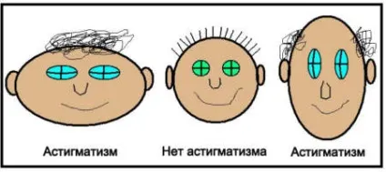 Як бачить людина з астигматизмом нечіткість і різь в очах