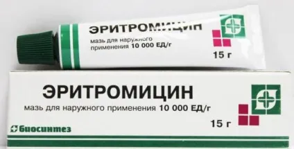 Комедони на обличчі як позбутися в домашніх умовах (комедони на обличчі як позбутися) Комедони на обличчі як позбутися в домашніх умовах