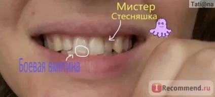 Лазерне відбілювання зубів - «ураааа я це зробила! », Відгуки покупців (зробила) Лазерне відбілювання зубів - «ураааа я це зробила!
