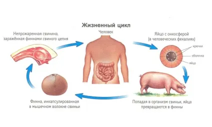 Стрічкові черв'яки у людини, симптоми і лікування глистів (людини) Стрічкові черв'яки у людини, симптоми і лікування глистів