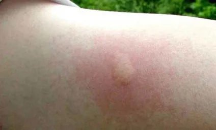 Лісові мурахи види, опис, користь і шкода