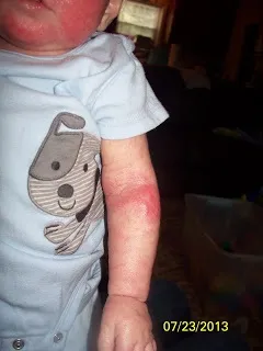Мама, не зупиняючись, загортають його в бинти, поки малюк кричав від мук (поки) Мама, не зупиняючись, загортають його в бинти, поки малюк кричав від мук