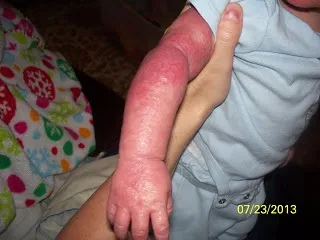 Мама, не зупиняючись, загортають його в бинти, поки малюк кричав від мук (кричав) Мама, не зупиняючись, загортають його в бинти, поки малюк кричав від мук