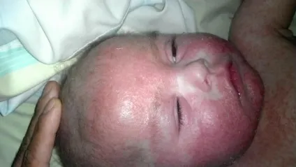 Мама, не зупиняючись, загортають його в бинти, поки малюк кричав від мук (малюк) Мама, не зупиняючись, загортають його в бинти, поки малюк кричав від мук